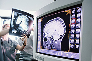 Ядерная медицина — современные инновации в борьбе с онкозаболеваниями.